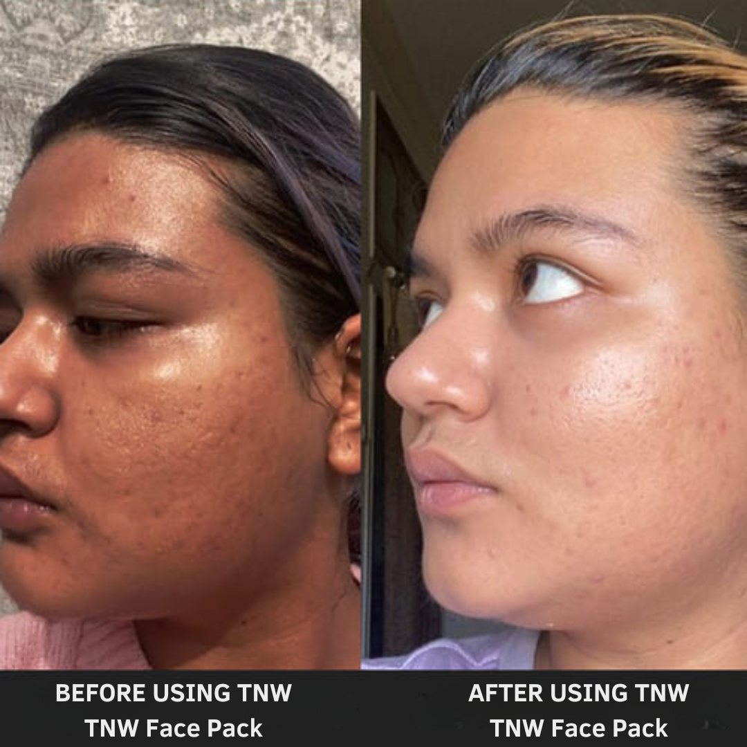 TNW Face Pack for Instant De-Tan and Glass Skin